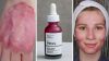 سرم لایه بردار پیلینگ سلوشن AHA و BHA اوردینری حجم 30 میل The Ordinary AHA 30% + BHA 2% Peeling Solution - Image 3