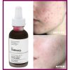 سرم لایه بردار پیلینگ سلوشن AHA و BHA اوردینری حجم 30 میل The Ordinary AHA 30% + BHA 2% Peeling Solution