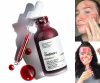 سرم لایه بردار پیلینگ سلوشن AHA و BHA اوردینری حجم 30 میل The Ordinary AHA 30% + BHA 2% Peeling Solution - Image 4