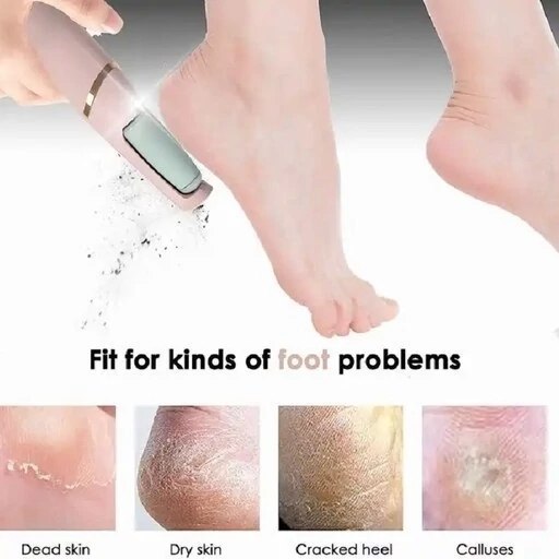 IMG_1670 سوهان پا ( سنگ پا ) شارژی اصلی PEDICURE TOOL - Image 1